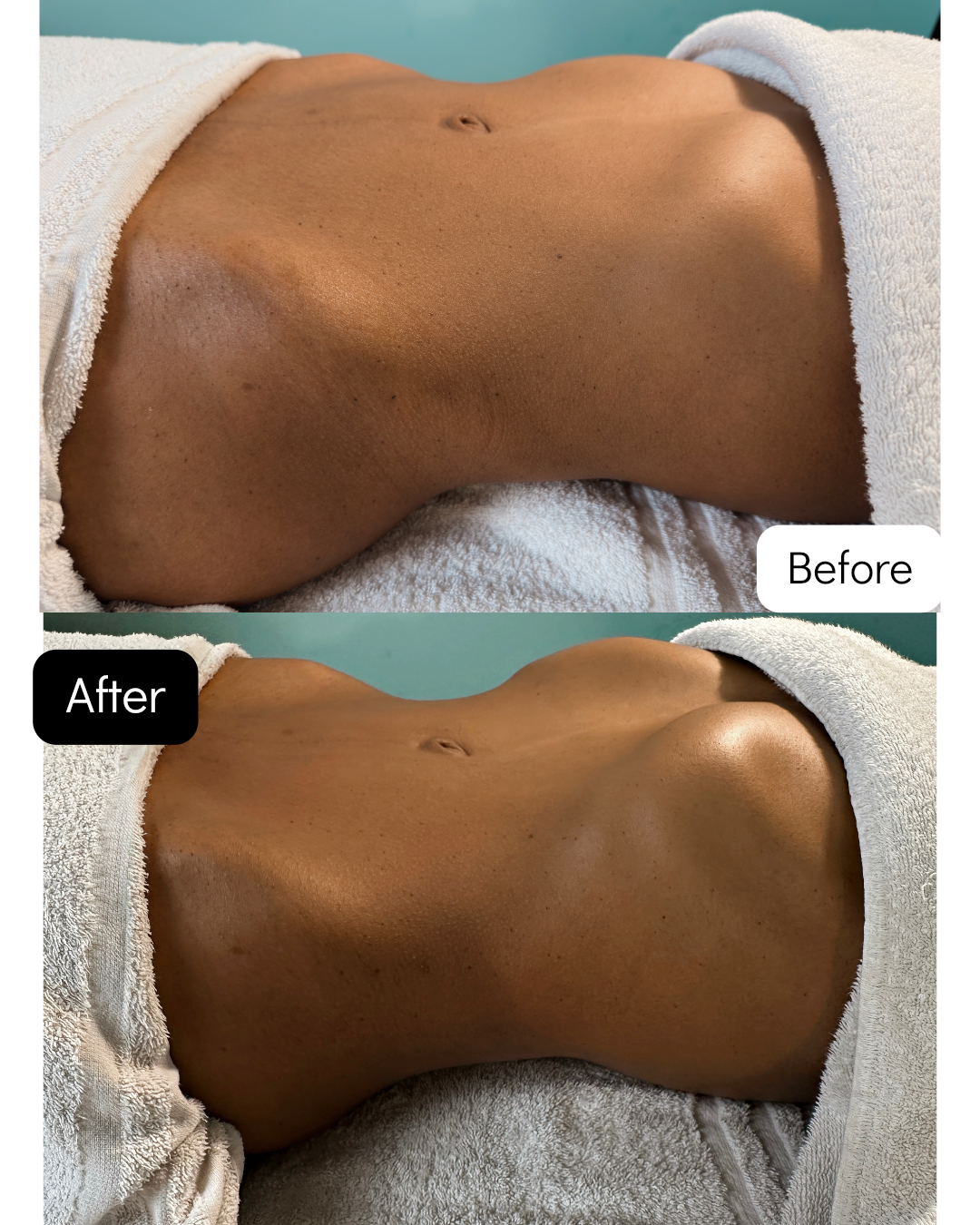 merybrylana-mery-brylana-massaggi-massage-centro-benessere-beauty-viso-massaggioviso-lifting-naturale-liftingnaturale-vitamina-vitaminac-trattamento-modellante-drenante